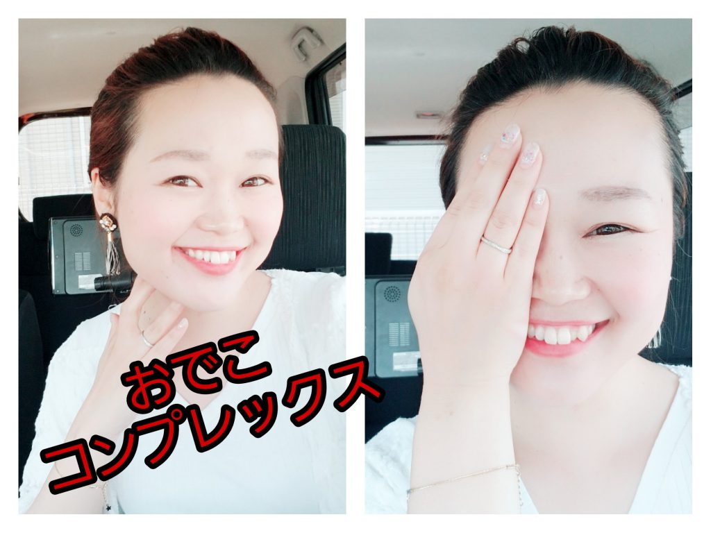 コンプレックスをいつまで持ってなくてもオーケー